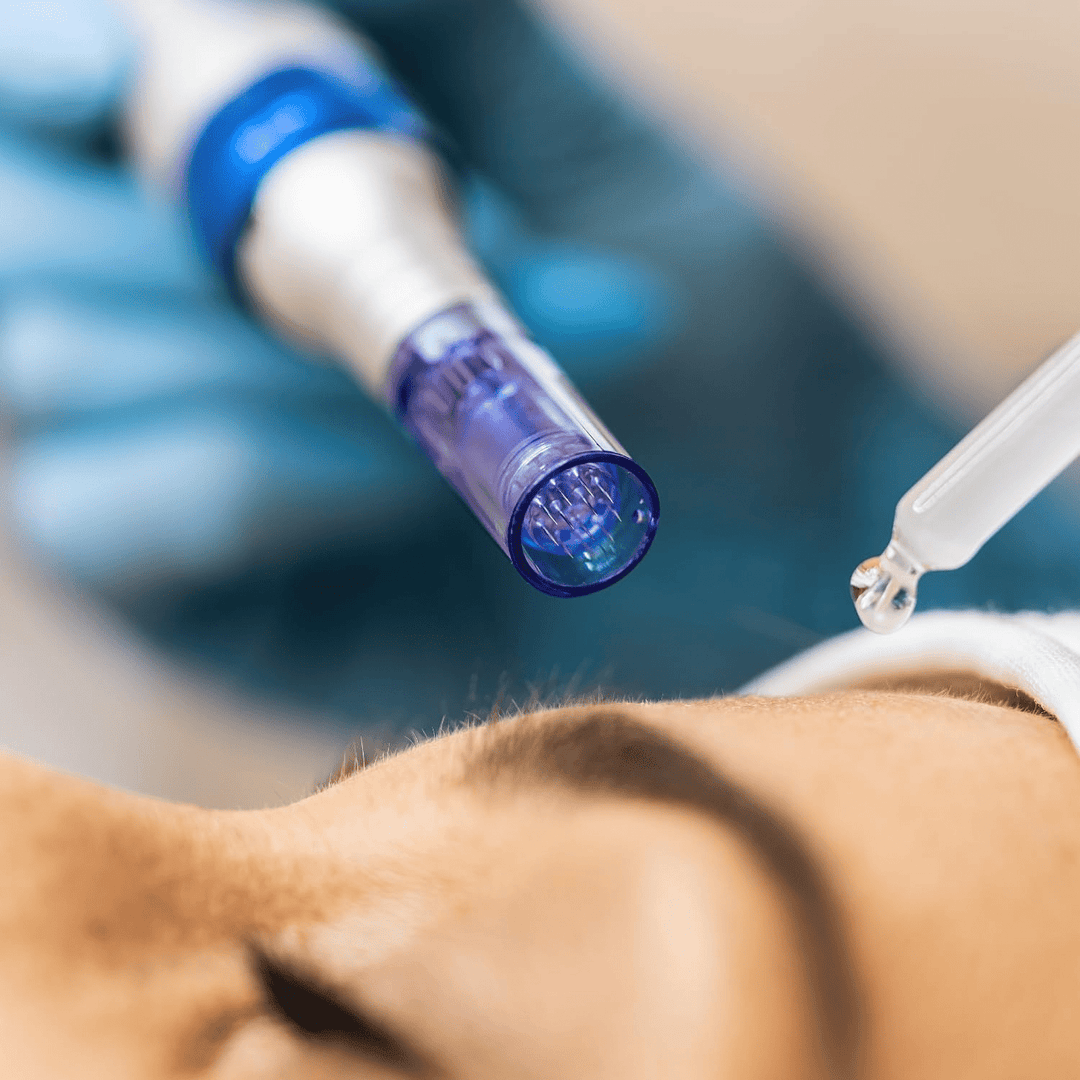 Instrument de masaj facial SHEIN, mix culori